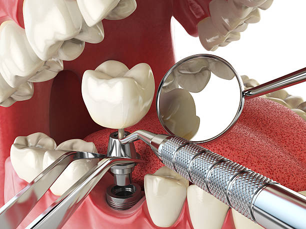 Best Emergency Root Canal Treatment in Blanchard, OK